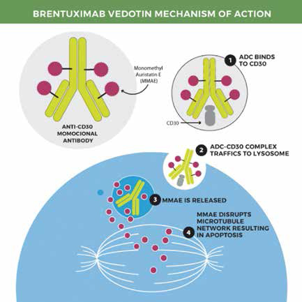 R/R PMBL 纳武利尤单抗联合Brentuximab vedotin有效