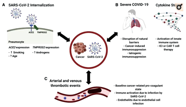 COVID-19大流行对全球肿瘤治疗和研究的影响