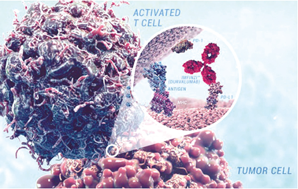 依托泊苷为基础一线治疗 ES-SCLC 联合 Durvalumab 或阿替利珠单抗或为最优选