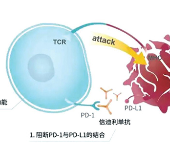无EGFR/ALK改变的AMnsqNSCLC 一线化疗联用信迪利单抗显著改善OS