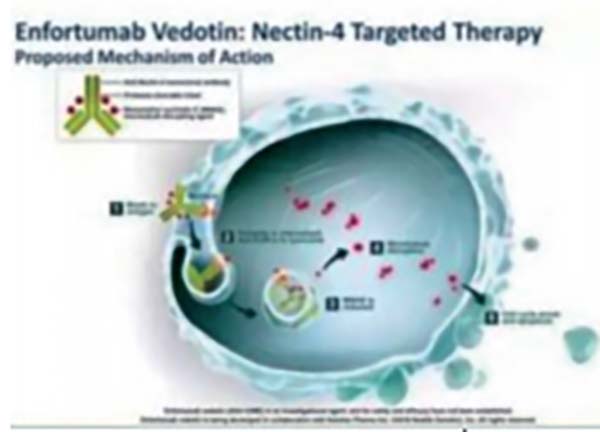  一线治疗不宜顺铂的la/mUC Enfortumab vedotin联合帕博利珠单抗缓解率高