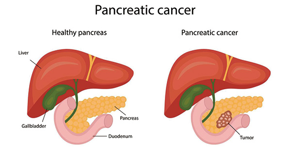 385-386期(完成)-33.jpg 385-386期(完成)-33.jpg