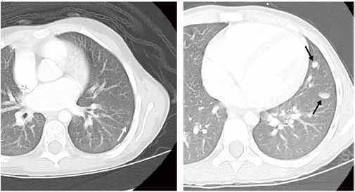 389-390期《全球肿瘤快讯》-70.jpg 389-390期《全球肿瘤快讯》-70.jpg
