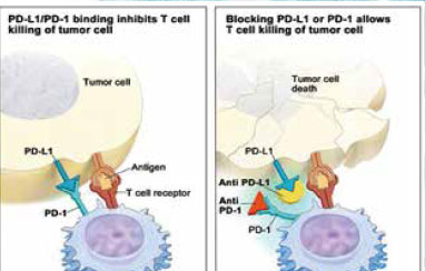 晚期NSCLC二线治疗 Nivolumab、Pembrolizumab、Atezolizumab孰优孰劣?
