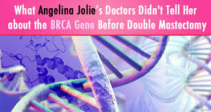 BRCA1与BRCA2 突变携带者的双侧乳房切除术