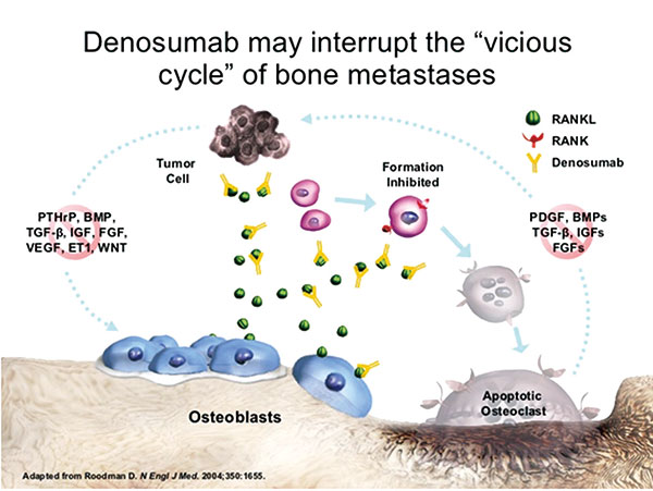 绝经后激素受体阳性早期乳腺癌 Denosumab辅助治疗安全有效