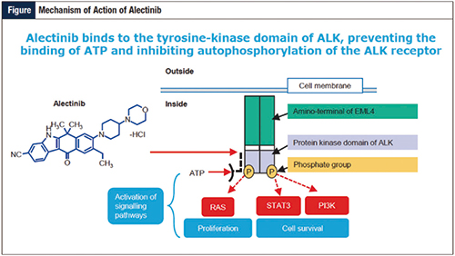 ALEX研究数据更新 Alectinib治疗PFS获益优于克唑替尼