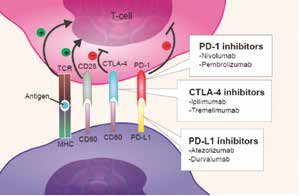 晚期胃食管交界癌 Durvalumab、Tremelimumab单用或联用的安全性和疗效