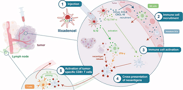 转移性肾细胞癌 Ilixadencel联合舒尼替尼治疗有效率翻倍 