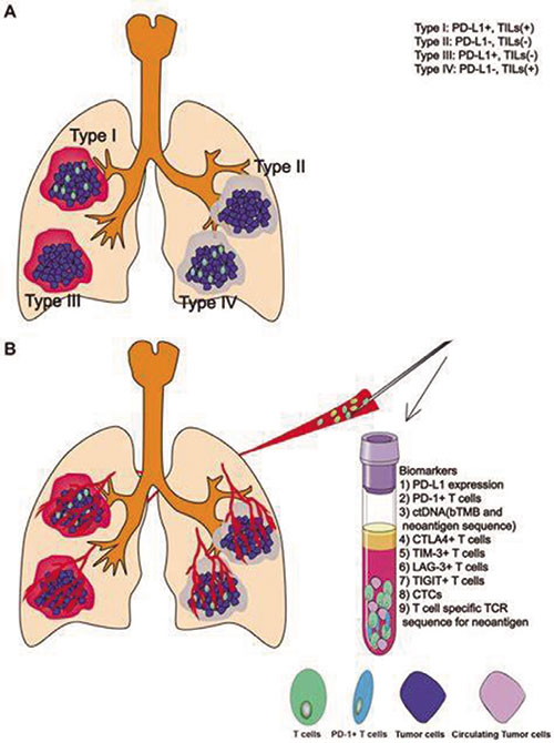合并HBV/HCV NSCLC免疫疗法似安全有效