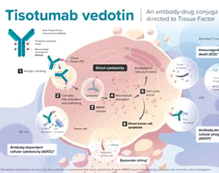 Tisotumab vedotin治疗转移性宫颈癌的疗效和安全性研究