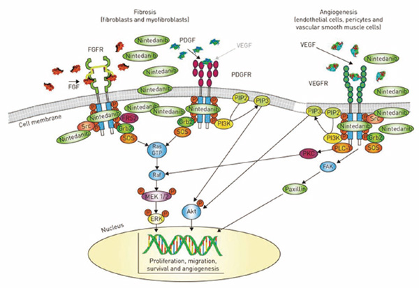 一线含铂化疗失败的晚期NsqNSCLC Nintedanib 联合多西他赛二线治疗研究