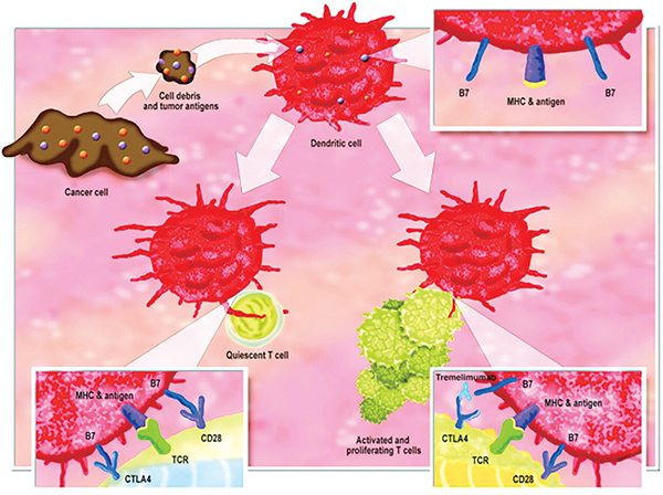 STK11、KEAP1、KRAS突变的肺鳞癌 一线化疗联合Tremelimumab、度伐利尤单抗或改善生存