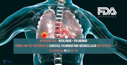 一线治疗晚期NSCLC 纳武利尤单抗联合伊匹单抗有长期生存获益