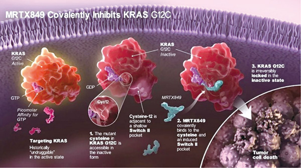 KRAS G12C突变的多线治疗失败的转移性结直肠癌 Adagrasib单药或联合西妥昔单抗均有抗肿瘤活性