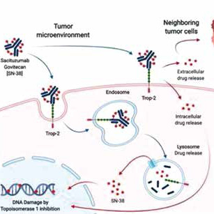 局部三阴性乳腺癌 Sacituzumab govitecan单药有效 