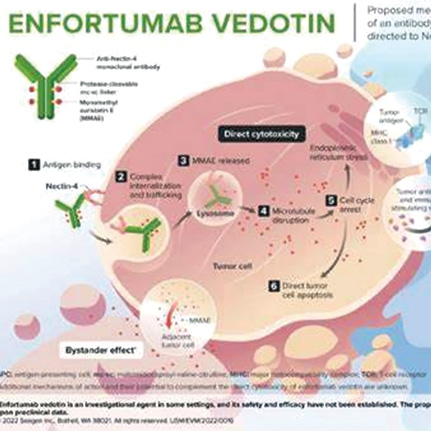 转移性尿路上皮癌 NECTIN4扩增常见且可预测Enfortumab vedotin疗效