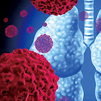 奥希替尼一线治疗失败的NSCLC 特泊替尼联合奥希替尼对MET扩增者有效 