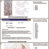 后线治疗ImS阳性mCRPC 纳武利尤单抗联合伊匹木单抗有前景