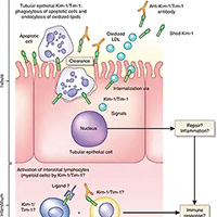 肾细胞癌术后 循环KIM-1水平升高有预后价值