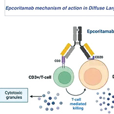 复发性或难治性滤泡性淋巴瘤 固定疗程epcoritamab联合R2方案安全有效