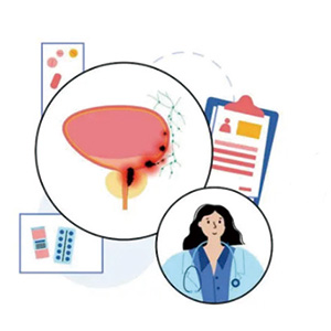 PSA值的个体差异显著，高值者次年检测多可降至阈值以下