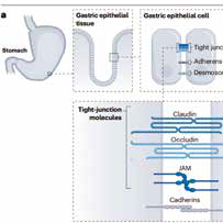 晚期胃癌 合并用药或影响CLDN18.2特异性CAR-T疗效​