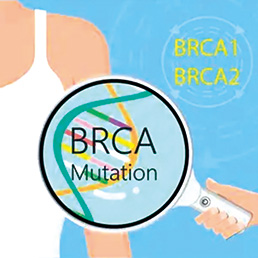 携带BRCA1或BRCA2致病性变异女性 更年期激素替代疗法不会增加乳腺癌风险​